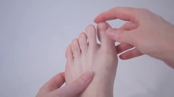 A nagylábujj deformitása. Lapos lábak. Az ujj helyzetének javítása kinesio ragasztószalaggal — Stock videók