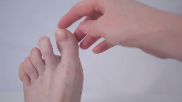 De eerste graad van misvorming van de grote teen. Halieux valgus. De hand trekt de vinger terug in de juiste positie. Gevolgen van hoge hakken. Een teken van platte voeten — Stockvideo