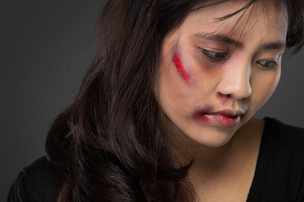 Asian woman victim of domestic abuse