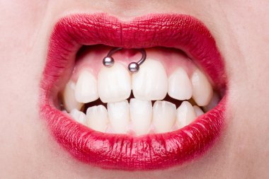 Smiley Piercing ile kadın