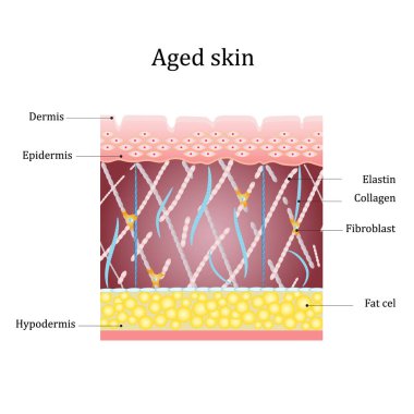 Yaşlanmış deri tabakası. Kolajen, elastin lifli, fibroblastlı insan cildi. Vektör diyagramı
