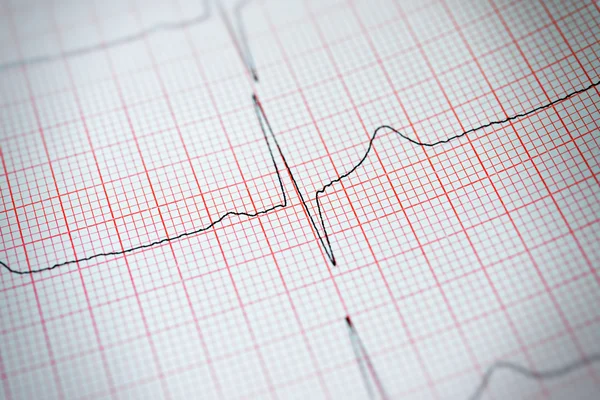 Electrocardiograma — Fotografie, imagine de stoc