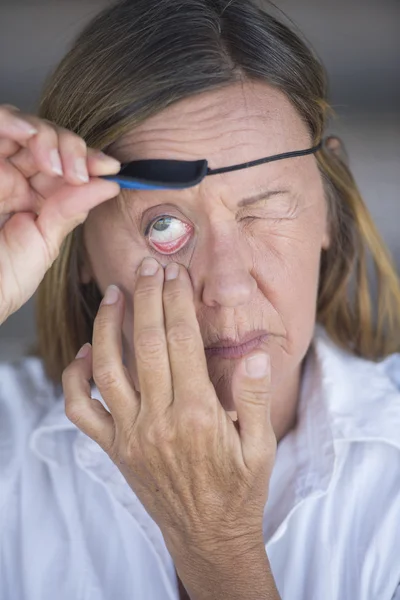 Mulher madura ferida levantando o retrato do remendo do olho — Fotografia de Stock