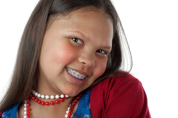 Diş telleri ile mutlu