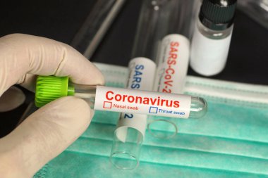 Laboratuvar teknisyeni geniz ya da boğaz temizleyicisi olan bir şişe gösterdi. COVID -19 (SARS CoV-2). Vücutta koronavirüs testi yapılıyor.. 