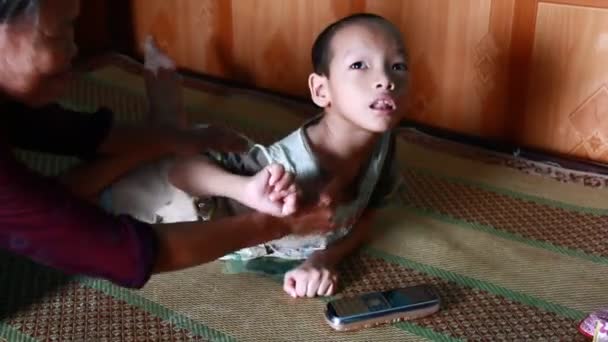 Anak Memiliki Cerebral Palsy — Stok Video