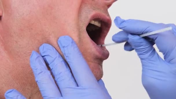 Mãos Femininas Raspando Dentro Bochechas Homens Membrana Mucosa Para Testes — Vídeo de Stock