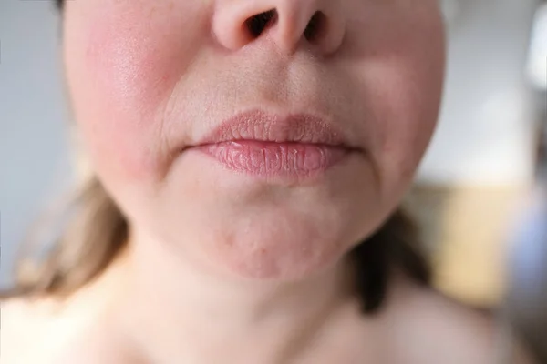 Labbra Bocca Mento Una Donna Mezza Età Parte Del Viso — Foto Stock