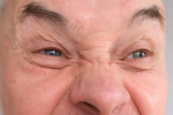 欧洲成年人的滑稽脸近视 老化皮肤上的皱纹 演员的鬼脸 人类的情感 精神疾病 — 图库照片