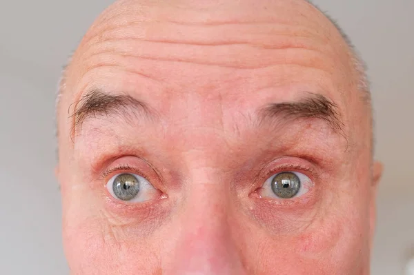 高齢者の額をクローズアップ 人間の視覚の回復の概念 視神経の健康 多毛症 視力検査 アンチエイジングの手順 人間の感情 — ストック写真