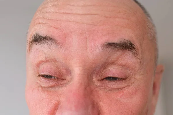 Eyes Forehead Elderly Man Close Concept Restoration Human Vision Health — Stock Photo, Image