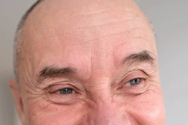 Eyes Forehead Elderly Man Close Concept Restoration Human Vision Health — Stock Photo, Image