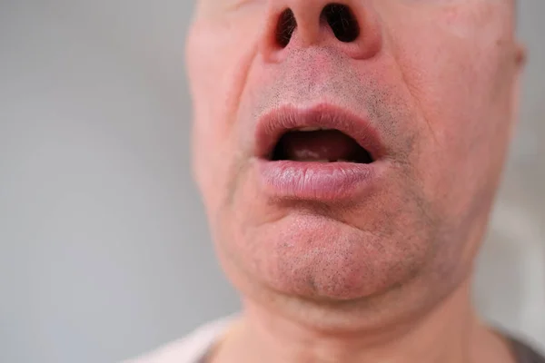 60代の白人男性の口の近さと正面図 強いしわ 顔の明るい感情 男性のスキンケアの概念 — ストック写真