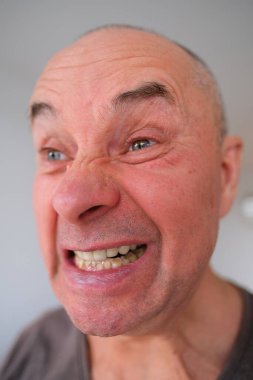 Avrupalı yaşlı bir adamın yüzü, yaşlanan cildinde kırışıklıklar, dişlerini gösteriyor, yüzünü buruşturuyor, ağzını açıyor, zihinsel sağlık kavramı, kozmetoloji, yaşla ilgili değişiklikler.