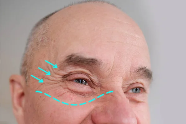 一位六十多岁的白人老人的灰蒙蒙的眼睛的近视和前视 他有很强的皱纹 脸上有明亮的情绪 有男性的护肤观念 — 图库照片