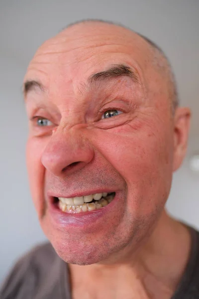 Face European Old Man Close Wrinkles Aging Skin Bares His — Stock Photo, Image