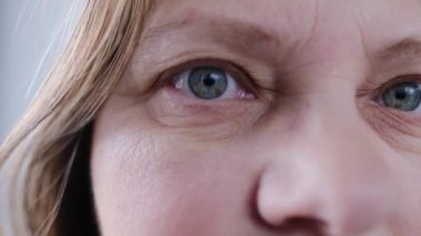 Gözlerinde benekler, göz kapaklarında kırışıklıklar, insan görüşü konsepti, optik sinir sağlığı, sinir tiki, miyopya, hiperopi, görme testi, genetik mühendislik. Kadın antenleri. sorun cildi 