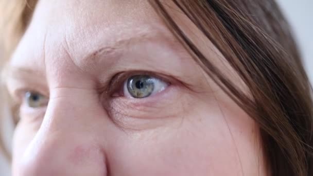 Gözlerinde Benekler Göz Kapaklarında Kırışıklıklar Insan Görüşü Konsepti Optik Sinir — Stok video