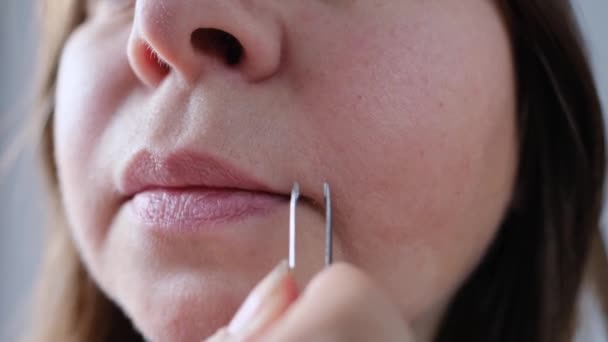 Pelo Sobre Labio Superior Las Mujeres Chica Con Pinzas Saca — Vídeo de stock