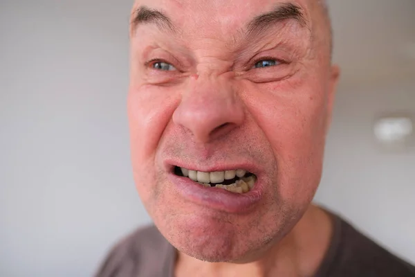 Лицо Европейского Старика Крупным Планом Морщины Стареющей Коже Обнаженные Зубы — стоковое фото