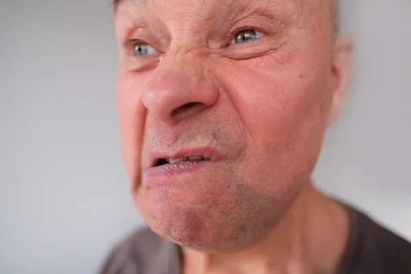 Обличчя Європейського Старого Чоловіка Зблизька Зморшки Старіючій Шкірі Болить Зуби — стокове фото