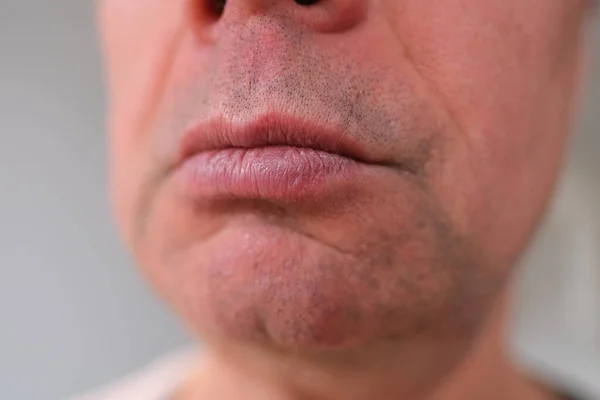Close Front View Mouth Old Caucasian Man His Sixties Strong — Stok Foto
