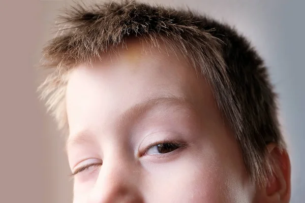 男の子 顔の一部 面白い目を閉じて 側を探して 幸せな小児期の概念 眼科疾患の治療 まぶた 子供の感情的な発達 — ストック写真