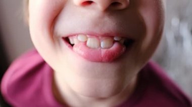 Çocuk, 8 yaşındaki çocuk dişlerini, dilini, konuşma bozukluklarını, düzeltmeyi, gelişim egzersizlerini gösteriyor.