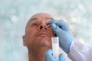 Yaşlı, kel bir adamın yüzü, laboratuvar asistanı, doktor burun mukozasından koronavirüs, DNA tespiti, COVID-19 konsepti için örnek alıyor.
