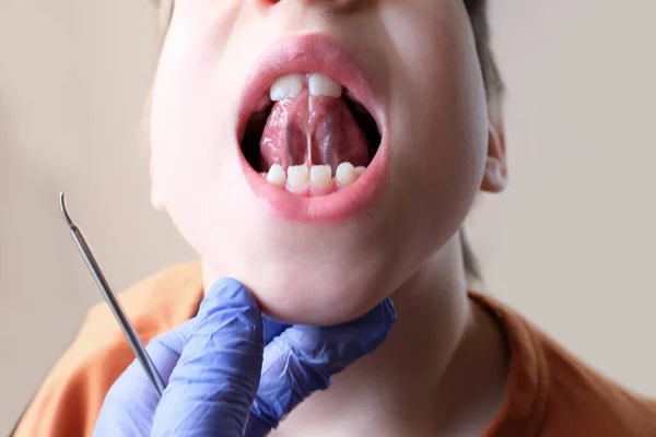 歯医者は小さい患者の口腔を検査し舌の熱狂の長さ少年子供は口のためのアーティキュレーション演習 言語障害の概念 修正を行います — ストック写真