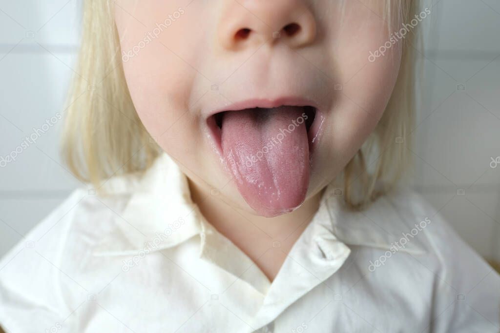 little child, baby, blonde girl showing tongue, mouth close-up, , concept of speech disorders, correction, frenum of tongue, methods of correctional developmental exercises