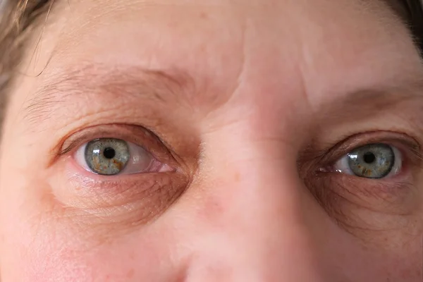 近视灰色眼睛 虹膜上有斑点 老年妇女睁开眼睛大美人 脸上有细小皱纹 化妆品抗衰老程序的概念 面部按摩 — 图库照片