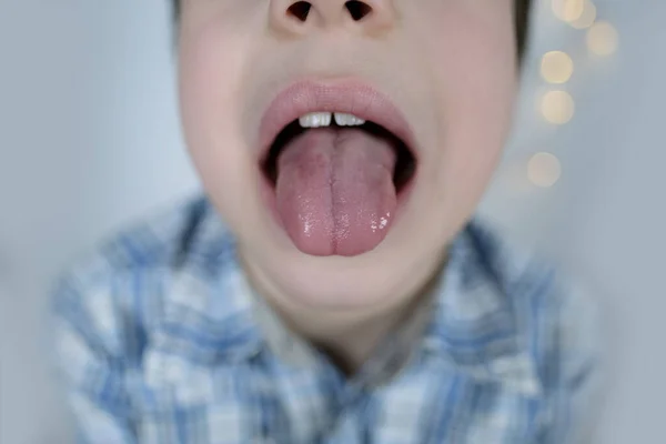 Küçük Çocuğun Komik Yüzü Çocuk Ağız Için Eklem Egzersizleri Yapıyor — Stok fotoğraf