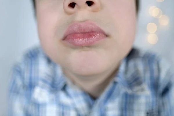 Gezicht Van Het Kind Een Jongen Close Lippen Gecomprimeerd Met — Stockfoto