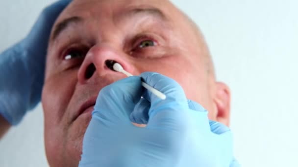 Close Male Doctor Gloves Takes Swab Sample Nose Analysis Rapid — Stock Video