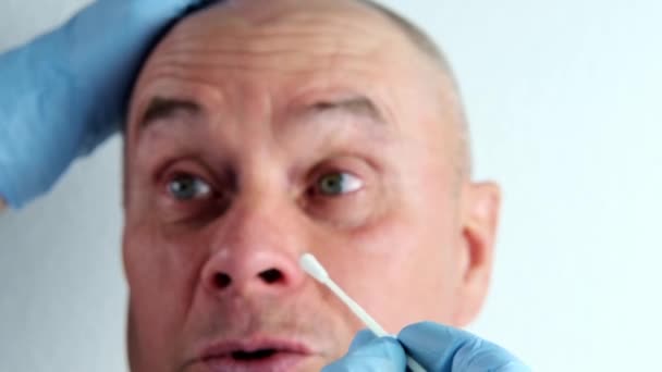手袋の男性医師のクローズアップは 分析のための鼻からの綿棒サンプルを取ります 迅速な鼻テストCovid ウイルス性疾患の早期発見の概念 SarsのCov 2流行 コロナウイルス — ストック動画