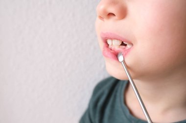 Küçük bir çocuk, 7-8 yaşlarında ağzı açık oturuyor, dişleri yakın, dişleri dişçi tarafından inceleniyor, diş tedavisi kavramı, ısırık kontrolü.
