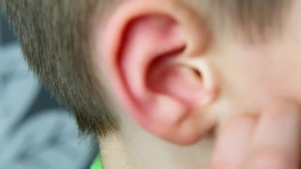 Close Part Head Child Kid Scratches His Ear His Hand — Stock Video