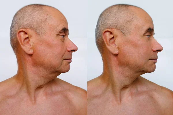 Close Face Elderly Bald Tanned Man Years Naked Torso Looking — Stok Foto
