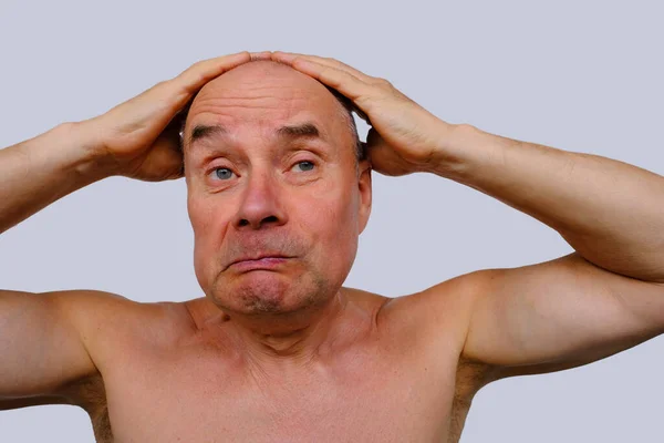 Yaşlı Adam Kafasını Tuttu Saçsızlıktan Saç Dökülmesinden Uzatılmasından Kellikten Cilt — Stok fotoğraf