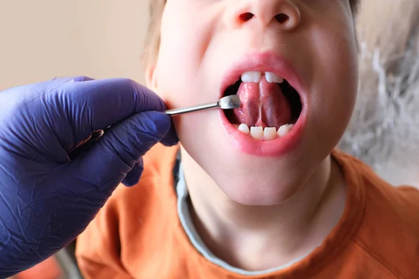 Dentista Médico Examina Cavidade Oral Paciente Pequeno Comprimento Frênulo Língua — Fotografia de Stock