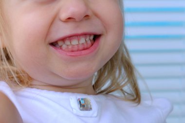 Küçük bir çocuğun yüzünün yakın çekimi, beyaz bluzlu sarışın bir kız 2 yaşında gülümsüyor, azı dişi, çocukluk kavramı, ağız temizliği, diş bakımı