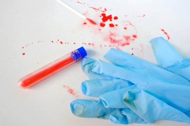 Beyaz masaya taze kan sıçraması, suç mahalli lekeleri, kan örneği toplama tüpü, adli tıp uzmanı örnekleri, adli tabip çalışma konsepti, polis laboratuarı.