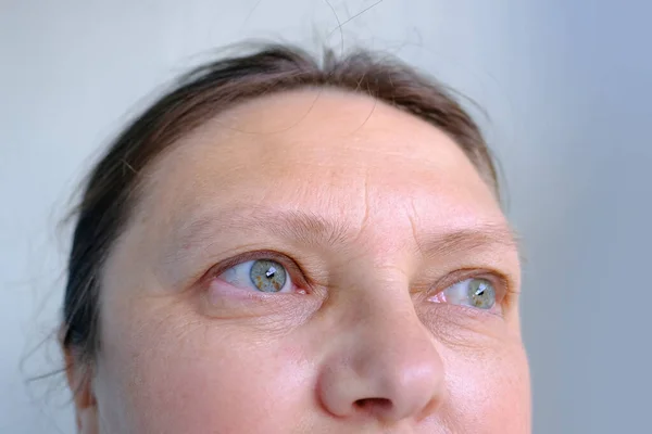 upper part of woman\'s face, an elderly woman close-up, small and large mimic wrinkles, eyes with spots, concept of poor vision, eye fatigue, drooping eyelid, correction of elasticity of aging skin