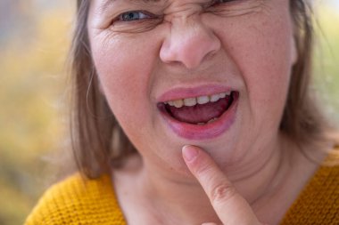 50 yaşında orta yaşlı bir kadın, insan kulağı çınlıyor, dinliyor, akustik işitme sistemi, işitme testi, koklear implant, yardımcı dinleme cihazı, sağlıklı yaşlanma, kaliteli olgun yaşam, sağlık kontrolü. 