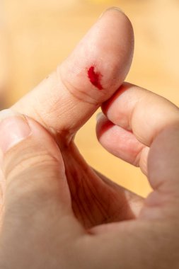 Dirseğine sarılı taze beyaz bandajlı yakın çekim kolu, yaralanma ve tedavi, kan veya plazma bağışından sonra donör, ilk yardım uygulaması, fiziksel travmadan sonra rehabilitasyon 