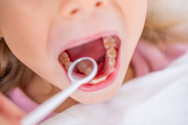 Bahçede çiçek açan beyaz çiçekleri keşfeden üç çocuk hasır şapkalı kız meraka erişiyor, ilkbahar doğa keşfi anı çiçek açan ağaçların yakınındaki polen hassasiyeti, mevsimsel alerji 