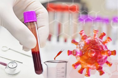 Covid-19 virüsü. Koronavirüs teşhisi için insan kanını laboratuvarda test eden bilim adamları..