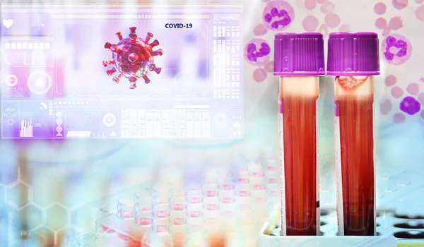 Covid-19 virüsü. Koronavirüs teşhisi için insan kanını laboratuvarda test eden bilim adamları..