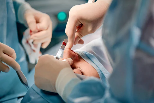 Orrplasztikai sebészek, a sebész kesztyűs kezei tartják a műszereket orrműtét közben. A kesztyűs orvos orrplasztika közben orvosi műszert tart. — Stock Fotó